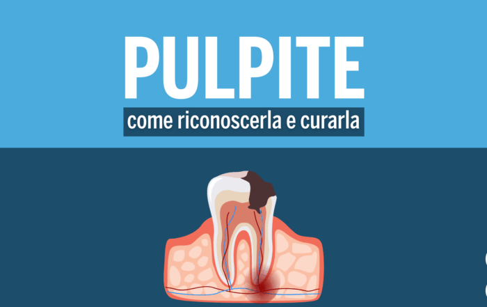 Pulpite dentale