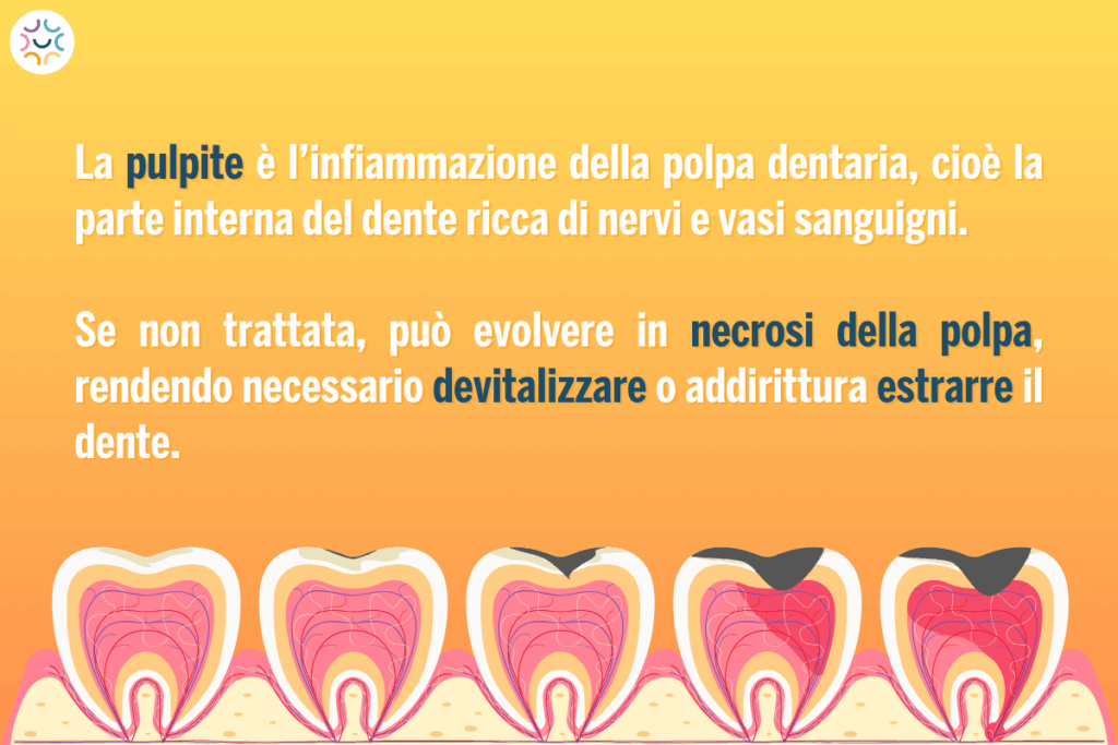 Pulpite cos'è