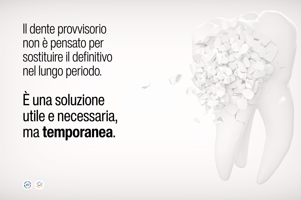 dente provvisorio quando va sostituito