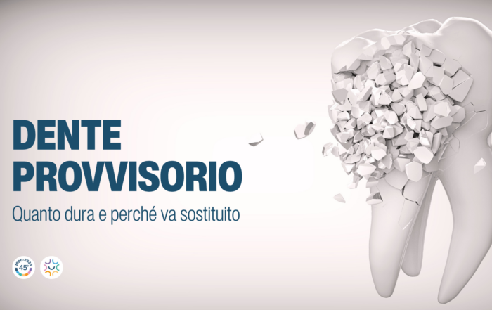 dente provvisorio quanto dura